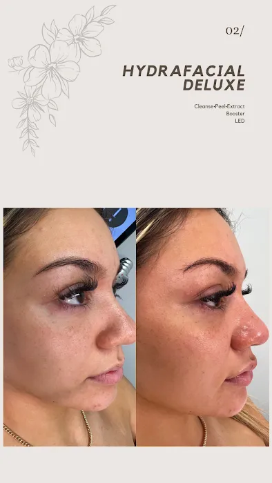 Opulent skin Miami Picture 10