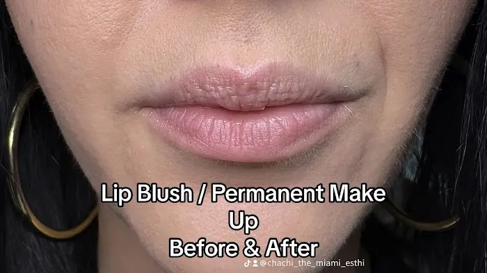 Opulent skin Miami Picture 3