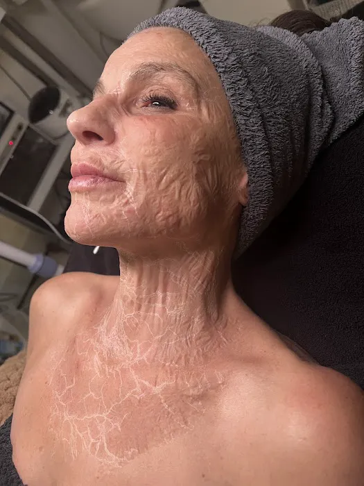 Opulent skin Miami Picture 8