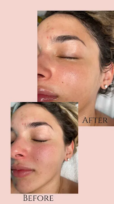 SKNNBYMARIEL Picture 9