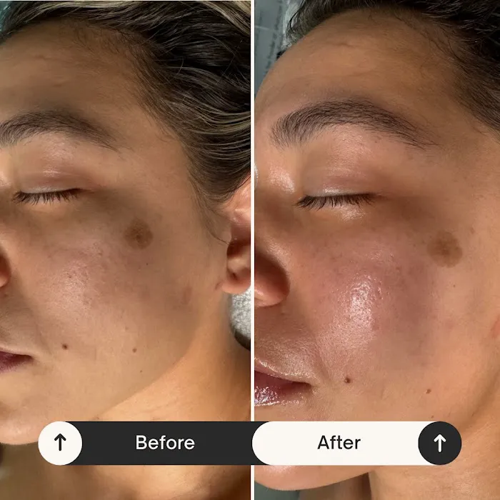 SKNNBYMARIEL Picture 4