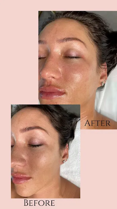 SKNNBYMARIEL Picture 1