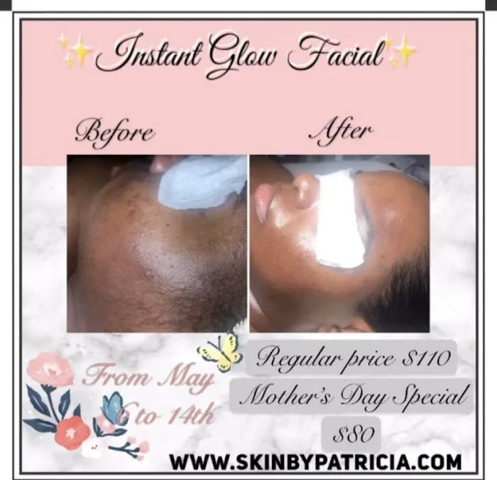 Skin by Patricia Picture 3