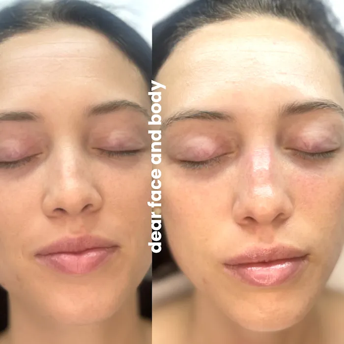 Dear Face and Body Picture 5