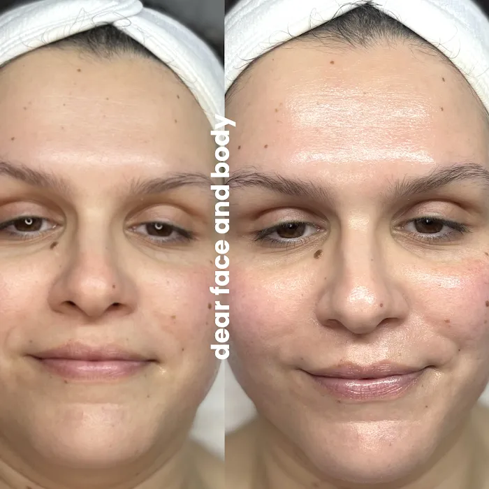 Dear Face and Body Picture 7