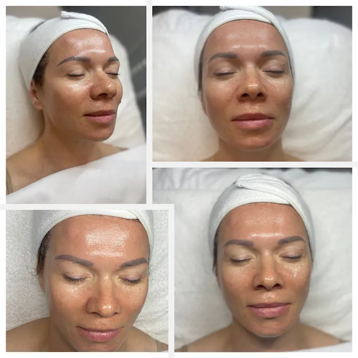 Dear Face and Body Picture 1