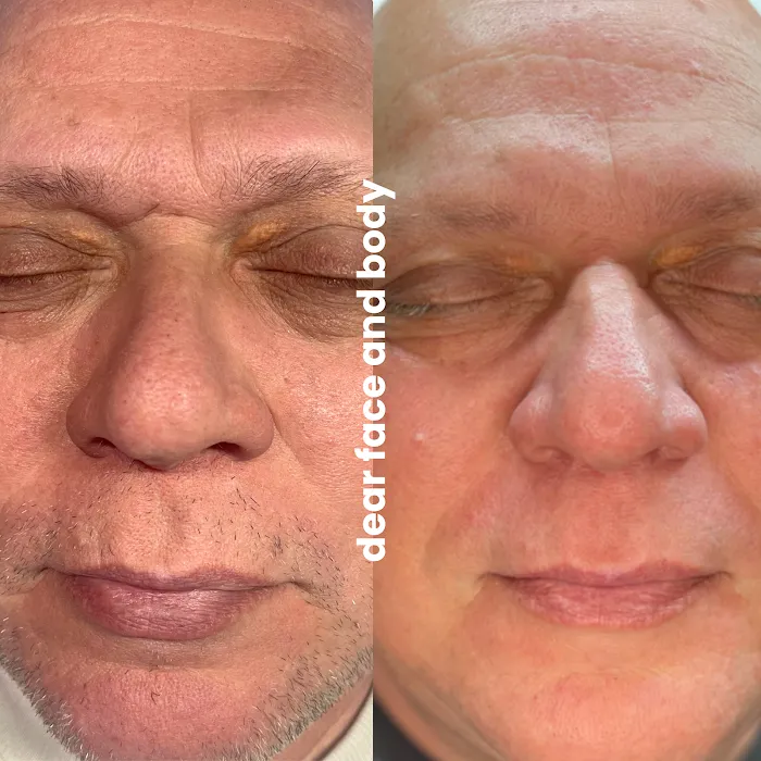 Dear Face and Body Picture 6