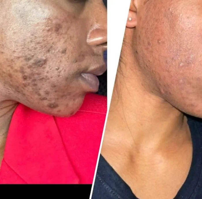 The Skin Code Picture 4