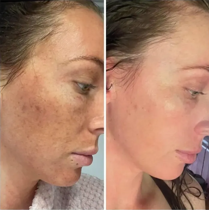 The Skin Code Picture 8