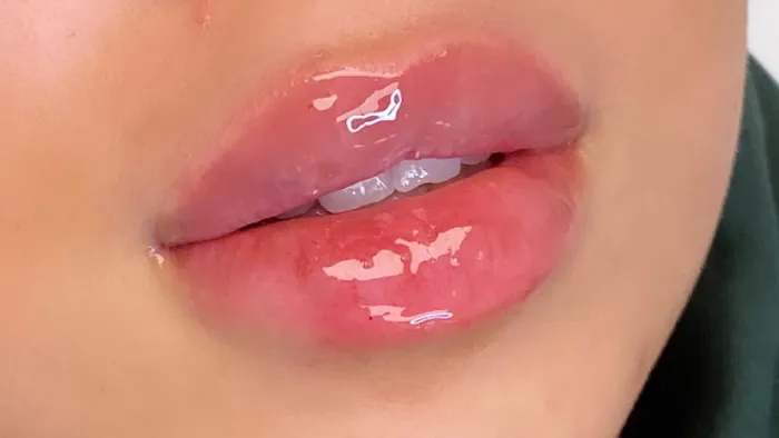 Lily Lips & Nose Picture 10