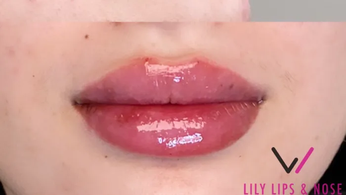 Lily Lips & Nose Picture 3