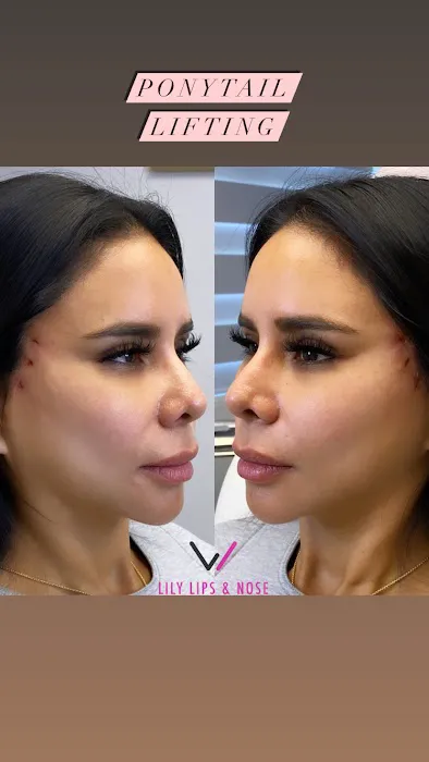 Lily Lips & Nose Picture 6