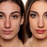 Marisol Naissir SPA ico