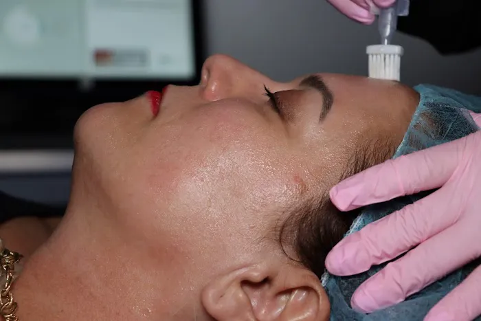 Lip Fillers Near Me LLC Picture 1