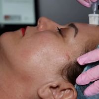 Lip Fillers Near Me LLC ico