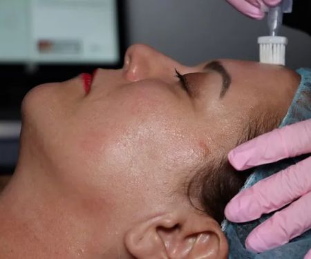 Lip Fillers Near Me LLC