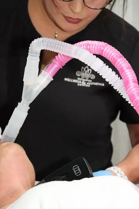 Lip Fillers Near Me LLC Picture 4