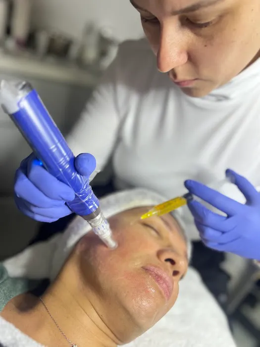 Skin Point Picture 2