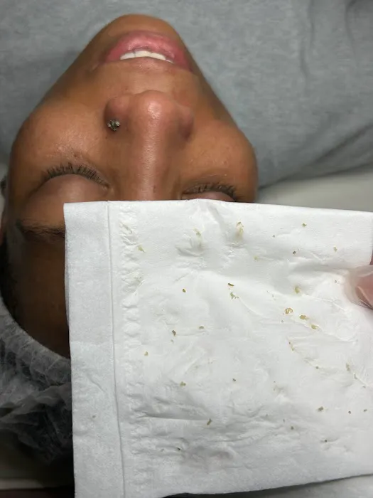 June First Skin Picture 6