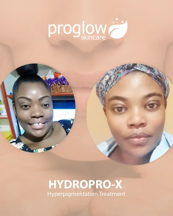 ProGlow.Studio International Picture 4