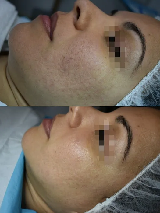 BioAesthetics Wellness Picture 6