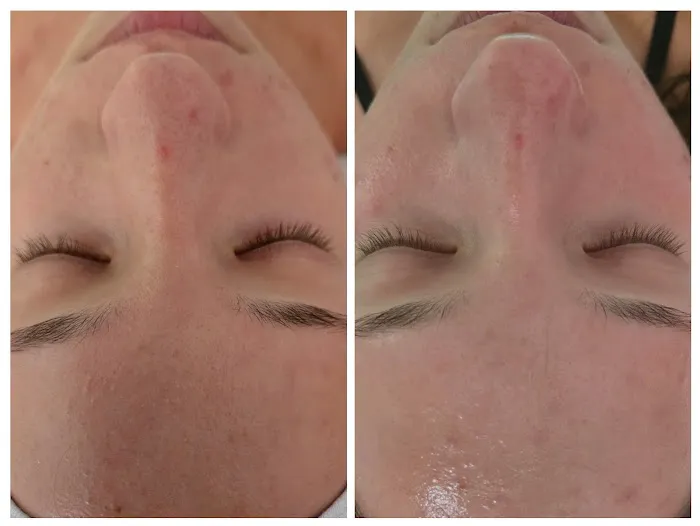 J.A. Esthetics Picture 7