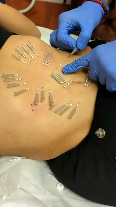 Aesthetics New Era Picture 4