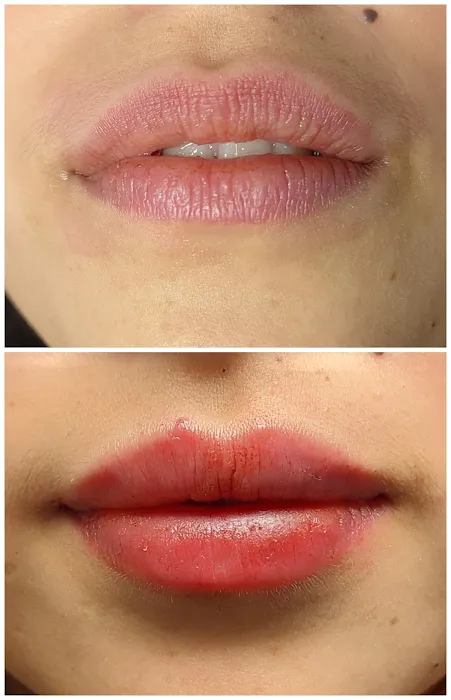 Aesthetics New Era Picture 10