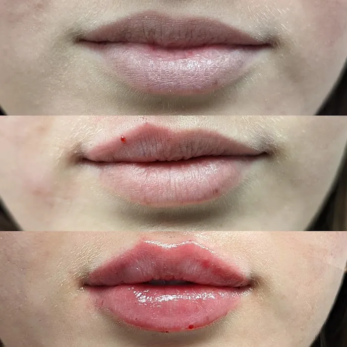 Aesthetics New Era Picture 3