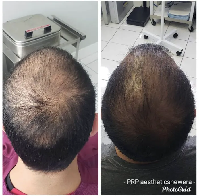 Aesthetics New Era Picture 9