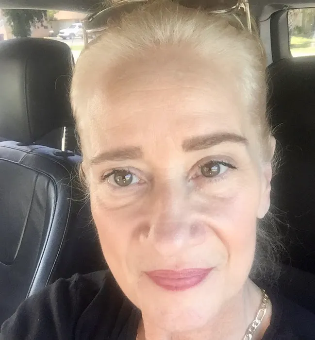 Miami Skin Tightening and Fat Reduction Picture 3