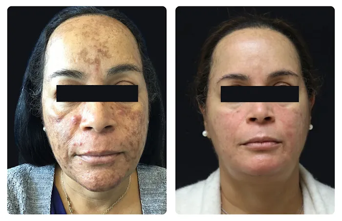 Glösense Dermatology & Aesthetic Picture 6