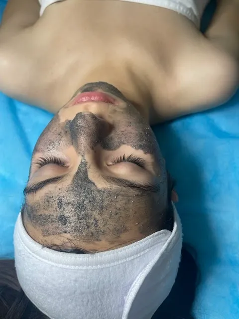 Facials Xpress Picture 7