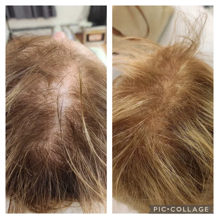 Renova Skin Picture 1