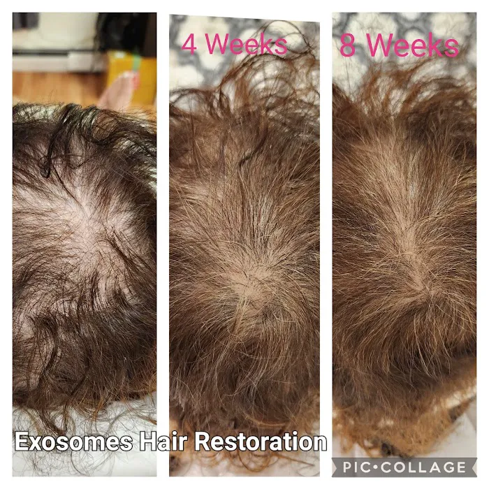 Renova Skin Picture 3