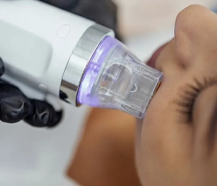 Adis Ventura Skin Specialist Picture 6