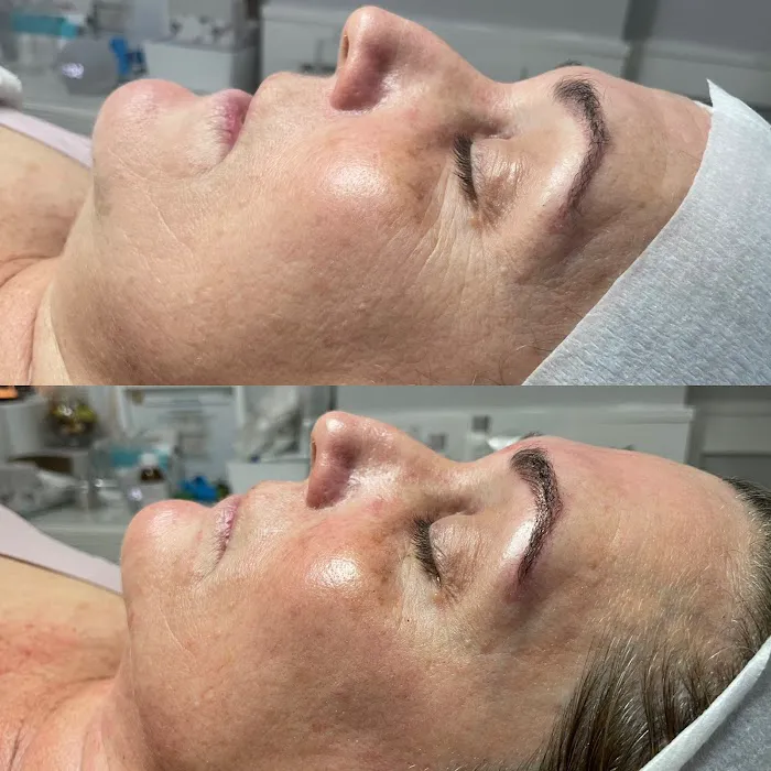 RenovaDerma The Skin Specialist Picture 4