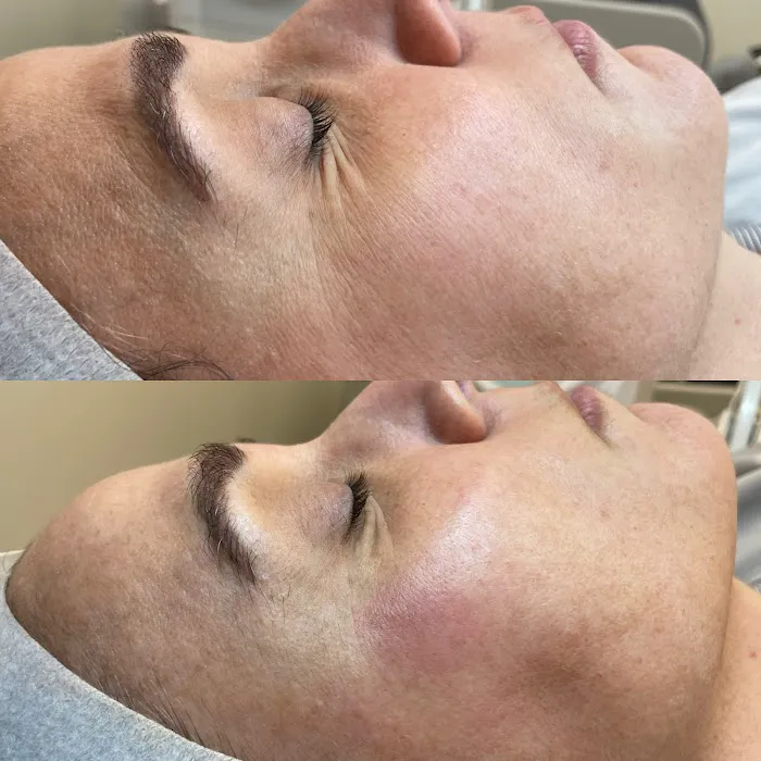 RenovaDerma The Skin Specialist Picture 3