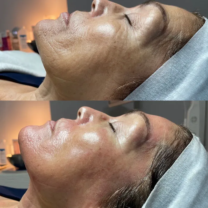 RenovaDerma The Skin Specialist Picture 6