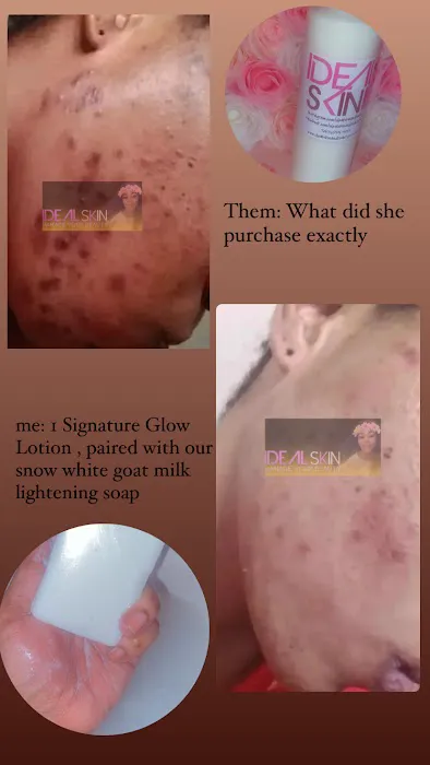 Idealskinandbeauty Picture 4