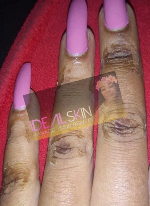 Idealskinandbeauty Picture 9