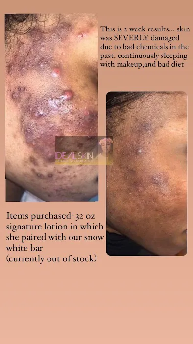 Idealskinandbeauty Picture 8