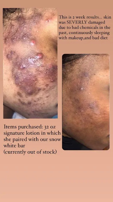 Idealskinandbeauty Picture 6