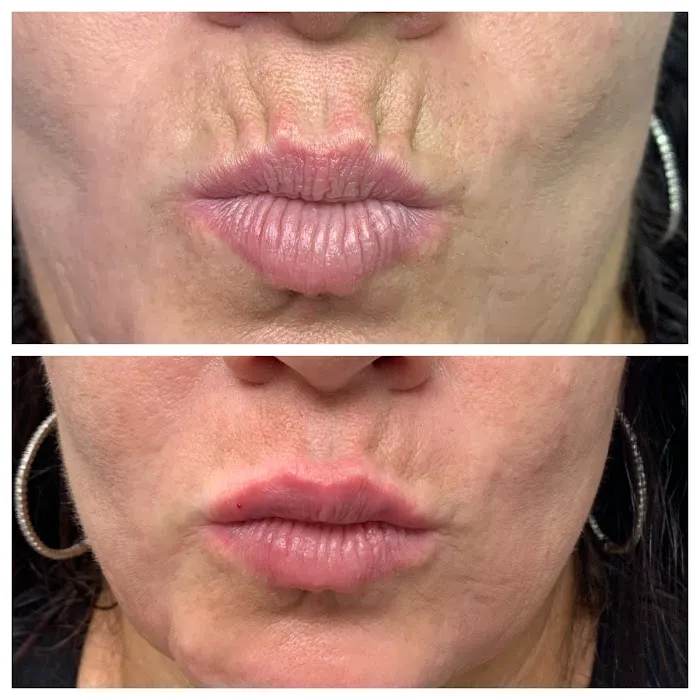 South Florida Aesthetics Picture 10