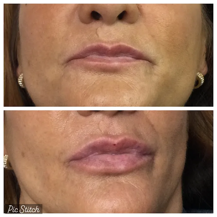 South Florida Aesthetics Picture 4