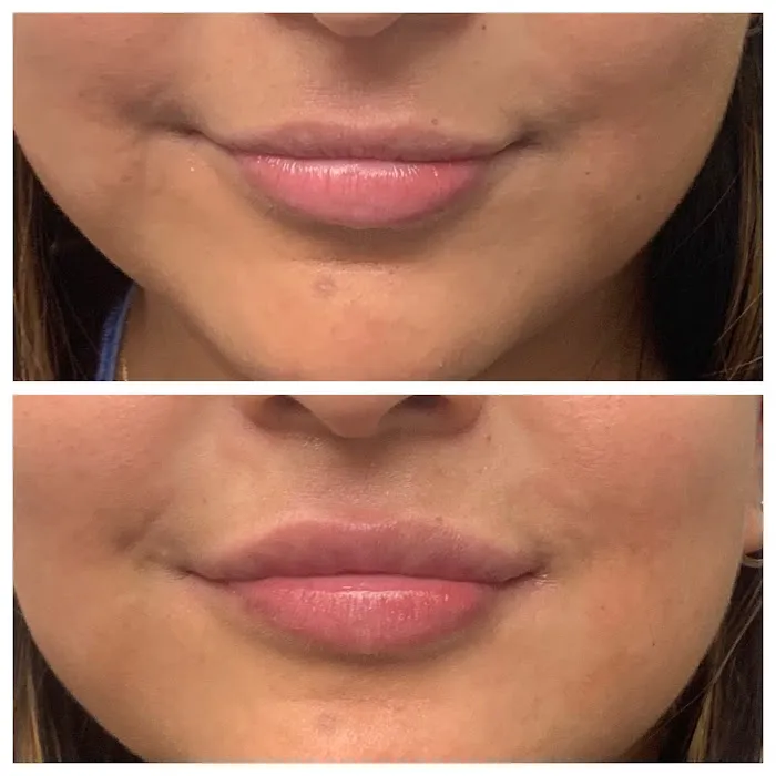 South Florida Aesthetics Picture 7