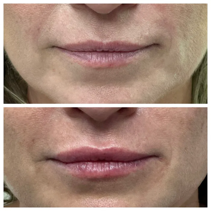 South Florida Aesthetics Picture 6