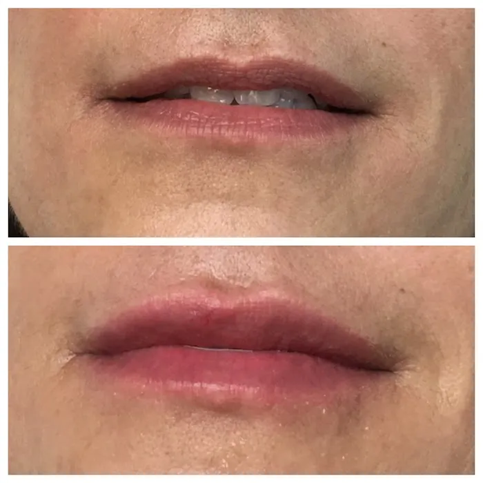 South Florida Aesthetics Picture 5