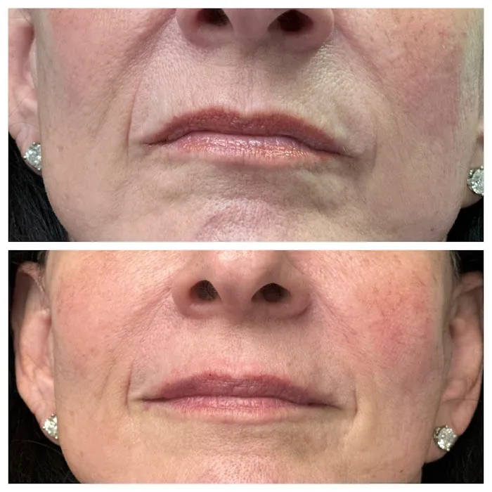 South Florida Aesthetics Picture 1