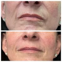 South Florida Aesthetics ico